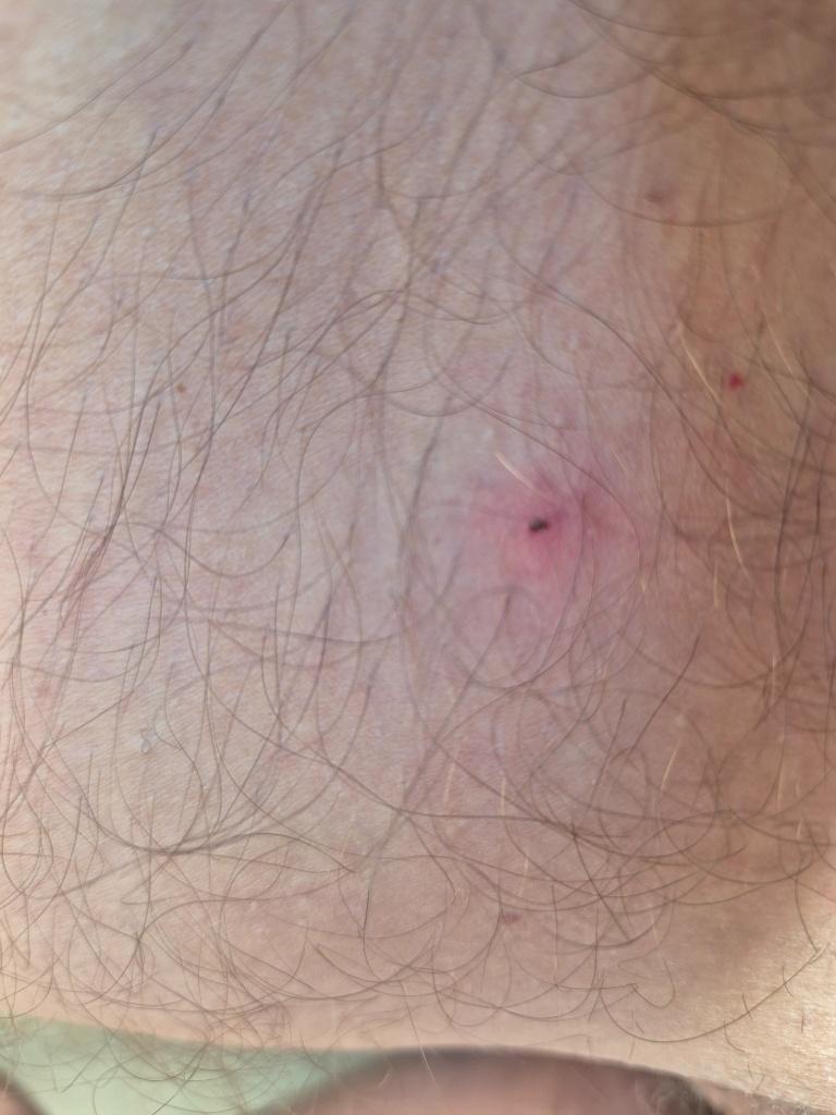 Tick