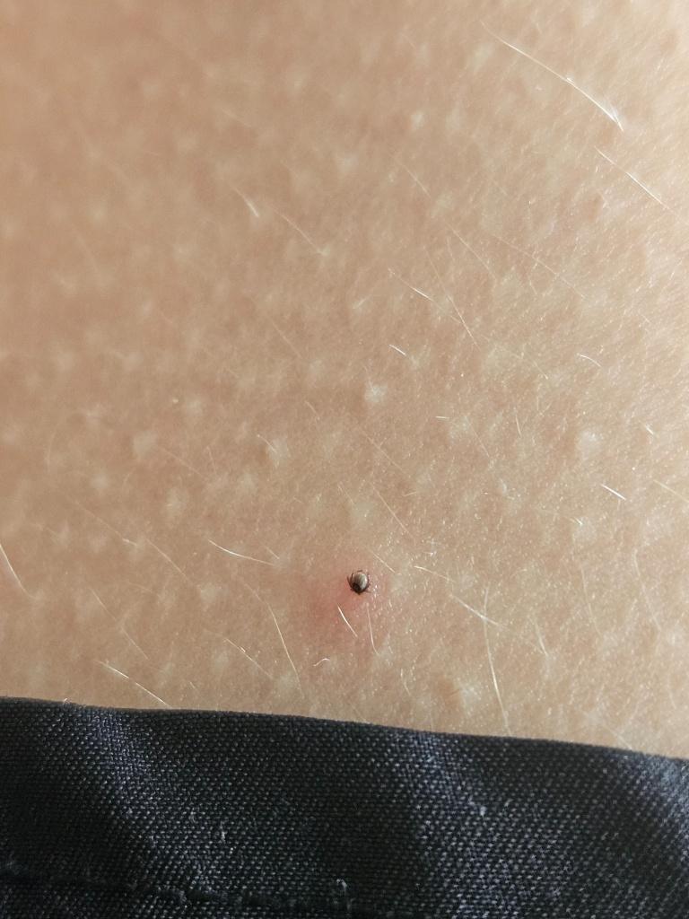 Tick