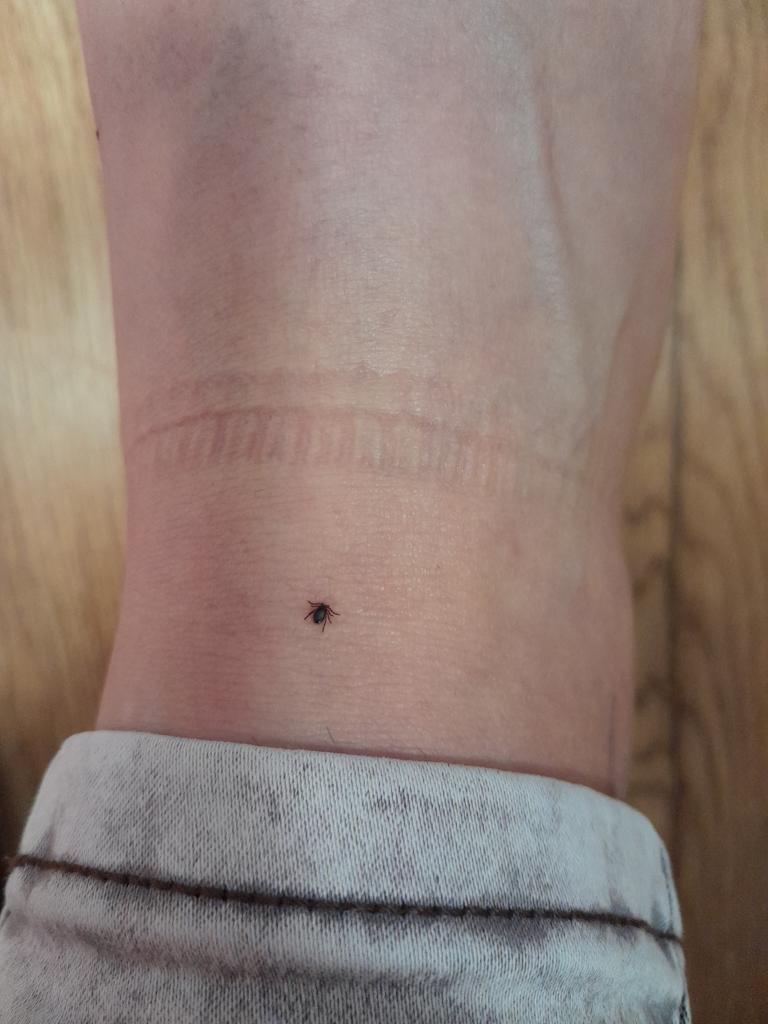 Příklad správné fotografie klíštěte 3